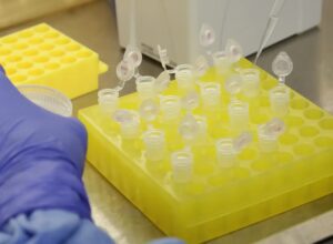 diagnostico_laboratorial_de_casos_suspeitos_do_novo_coronavirus_2801209411.jpg